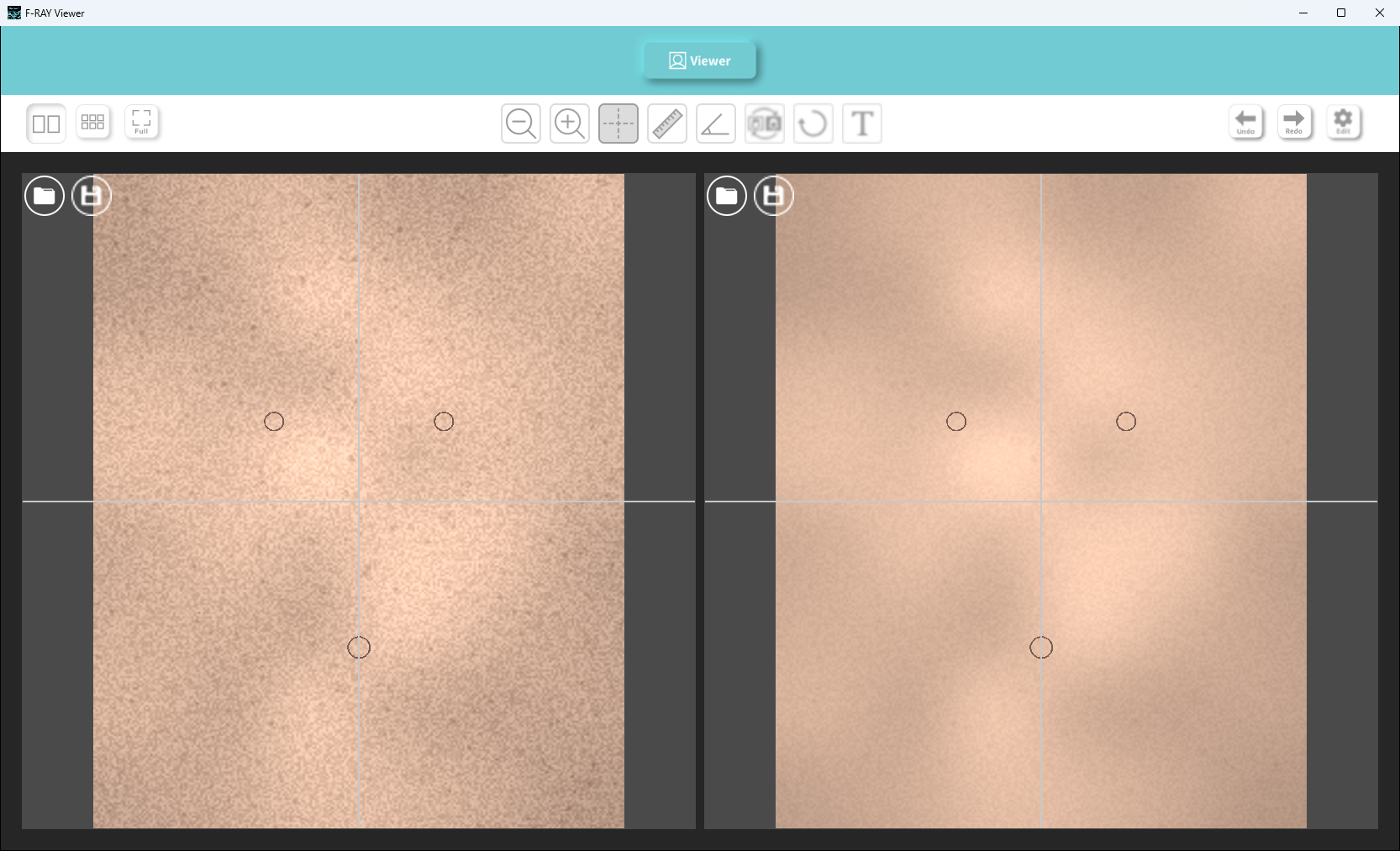 Crosshair guideline overlaid at the same position across all views