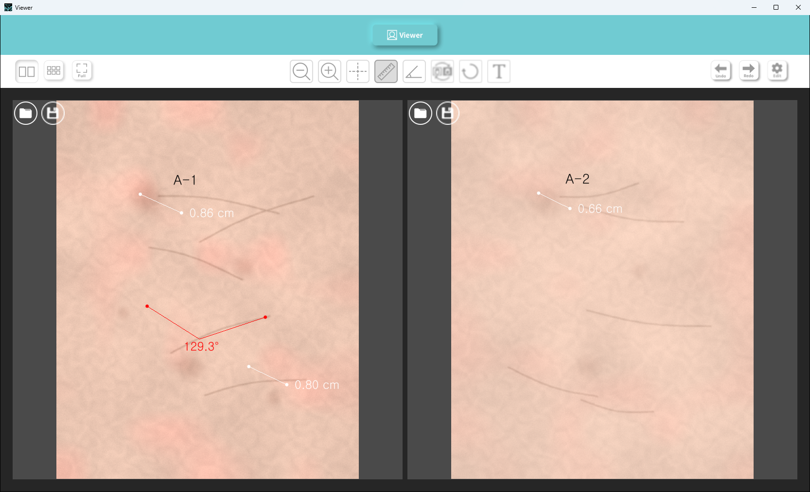 Two-pane view showing a pair of captures with length and angle measurements
