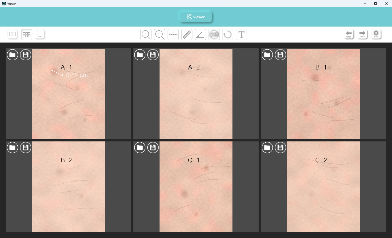 Six-pane layout comparing six captures at once