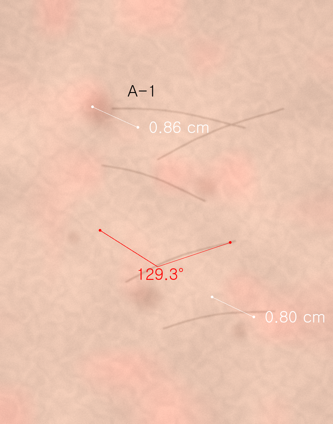 Exported image with measurement lines, angle and note burned in
